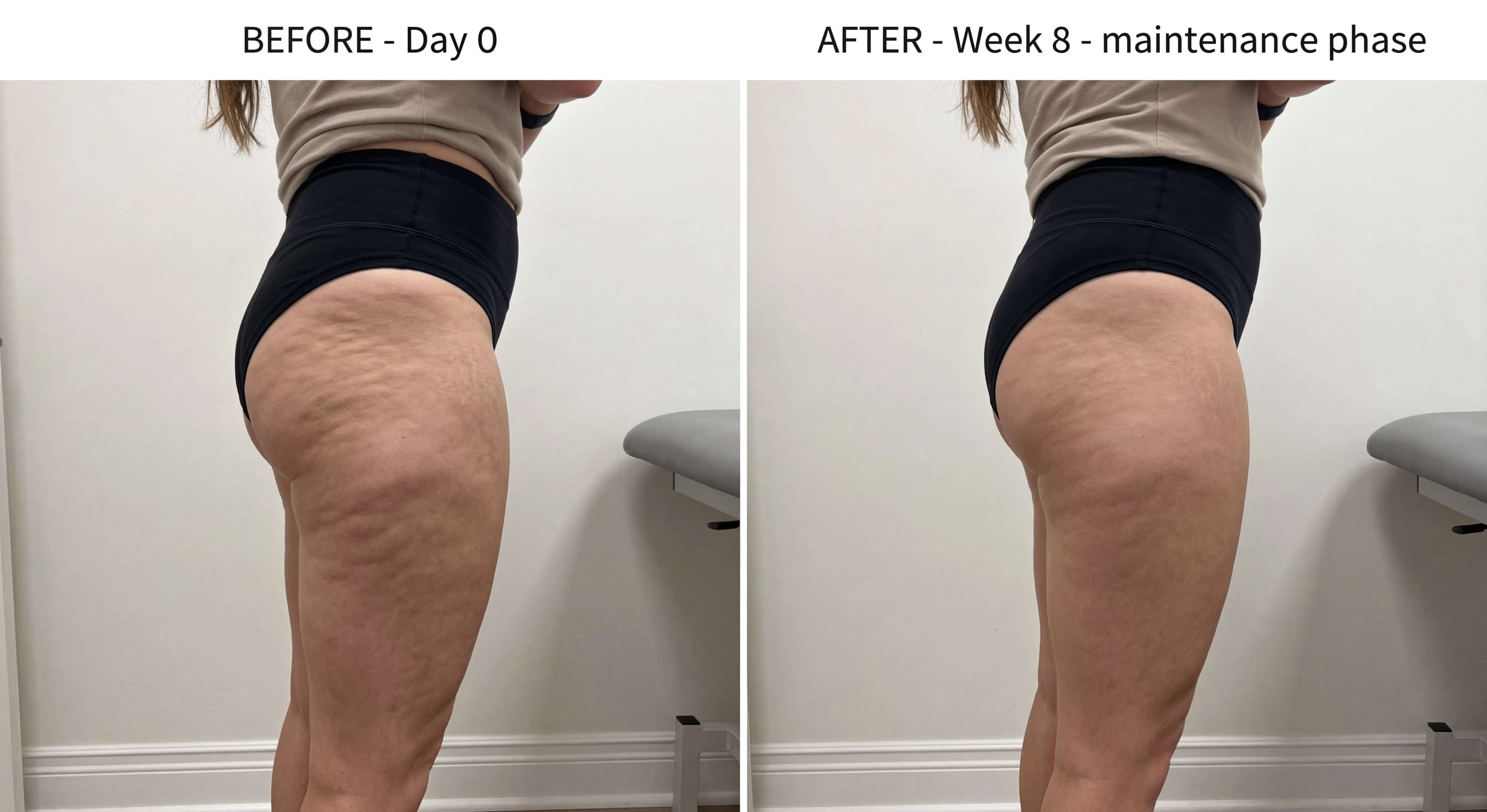 Client before and after