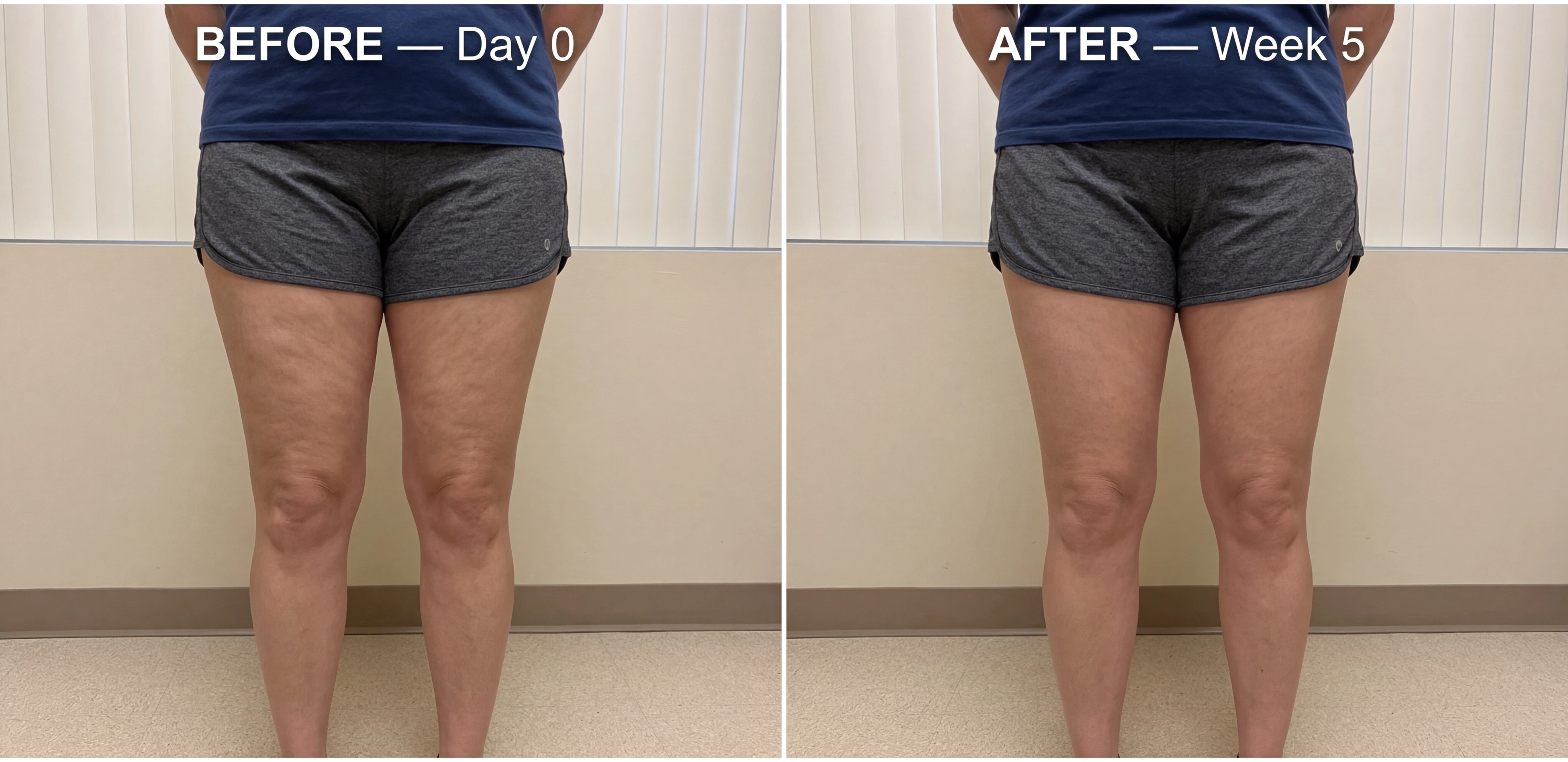 Dana before and after