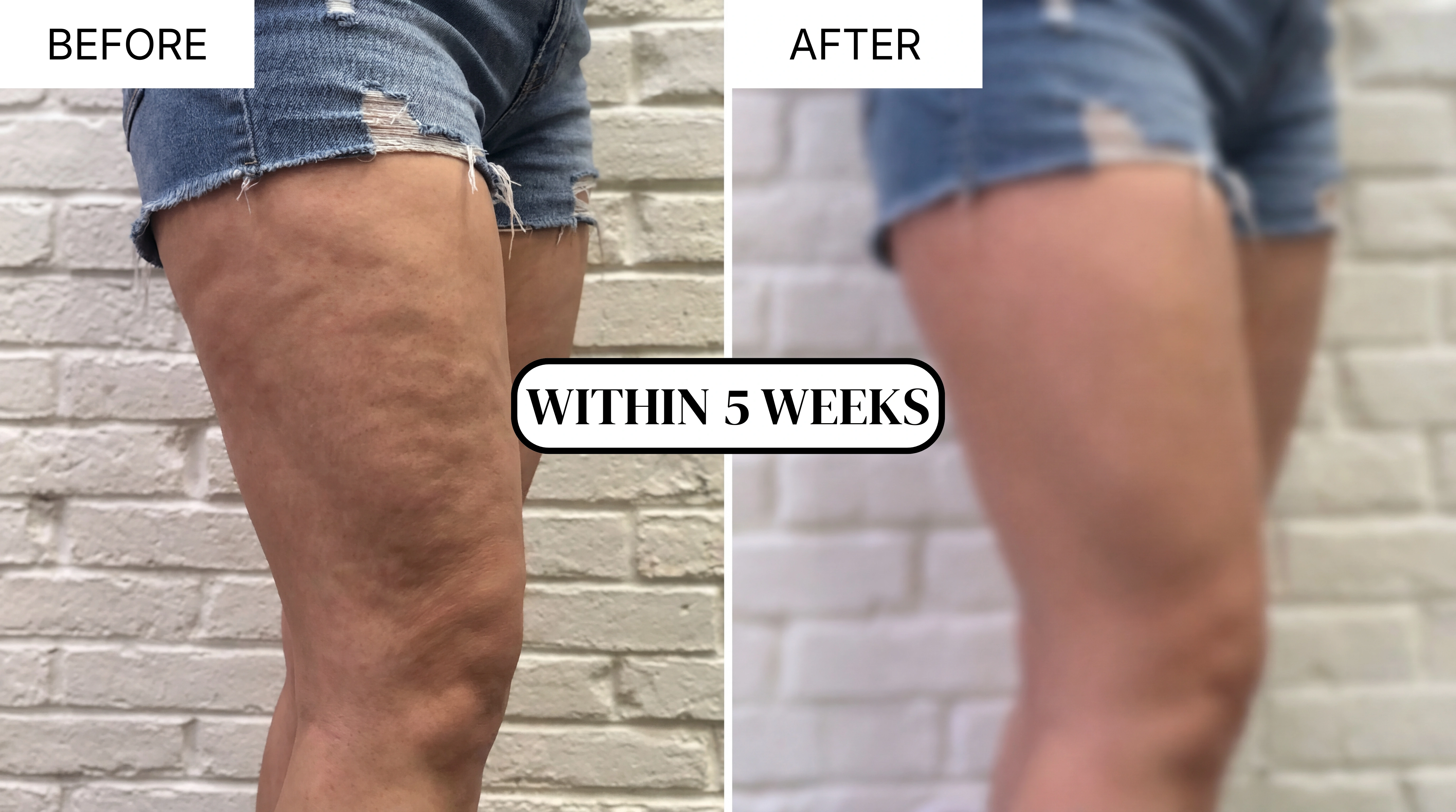 Before and after results